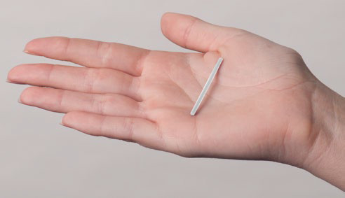 Contraceptive implant